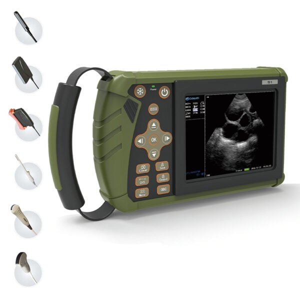 2021 Full Digital Palmtop Bladder Ultrasound Scanner Color Ultrasound Machine With Convex
